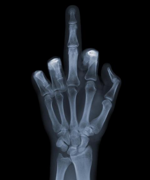x-ray-photography-nick-veasey-chicquero-middle-finger-fuck-you.jpg